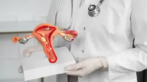 What is the Best Treatment for Uterine Polyps?